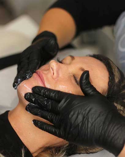 Dermaplaning in Saltash