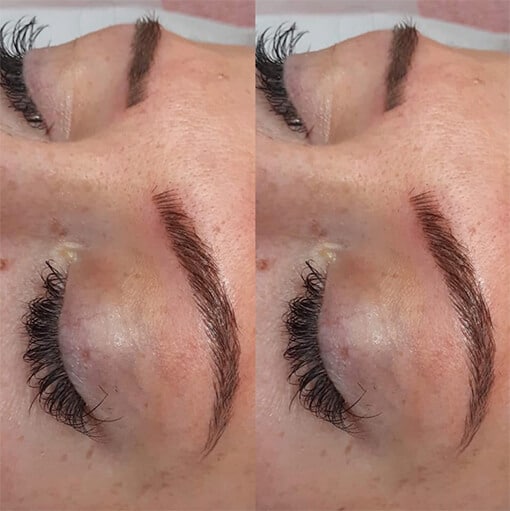 Microblading